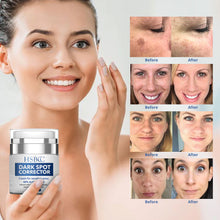 Load image into Gallery viewer, Dark Spot Remover for Face and Body, Dark Spot Corrector- Formulated with Arbutin, Niacinamide & Vitamin E